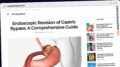 Publish Guest Post on nowayband.com